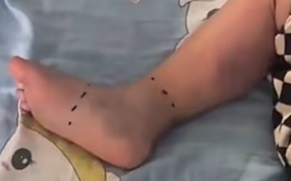 2岁幼童疑菜市场接触鱼住进ICU 5天花了8万元！