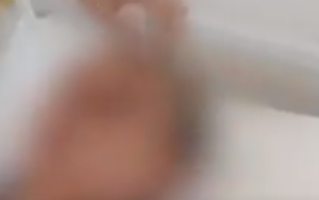 37岁男子连坐2次过山车致颅内出血 背后真相是什么？