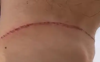 大学生骑车遭风筝线割喉:差点窒息 心软放大爷走了！