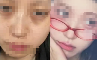 女生打工垮脸向老板索赔1万元“颜值折损费”成功 还给了3天的美容假！