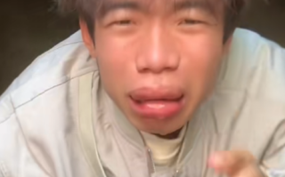 00后小伙回家跟老爸一起养蜂 被蛰成“香肠嘴”!