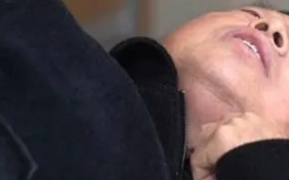 男子暴瘦痛苦求医 每次只能咽下一粒米！