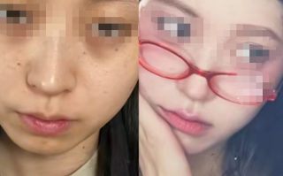 00后女生因打工累丑向公司索赔成功：1万元颜值折旧费！