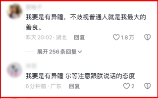 7岁女孩天生异瞳：妈妈担心受歧视 网友却集体羡慕!