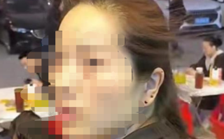 客人就餐头发竖起变“海胆头” 背后真相是什么？