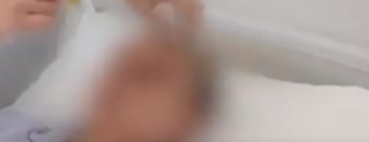 37岁男子连坐2次过山车致颅内出血 背后真相是什么？-第1张图片